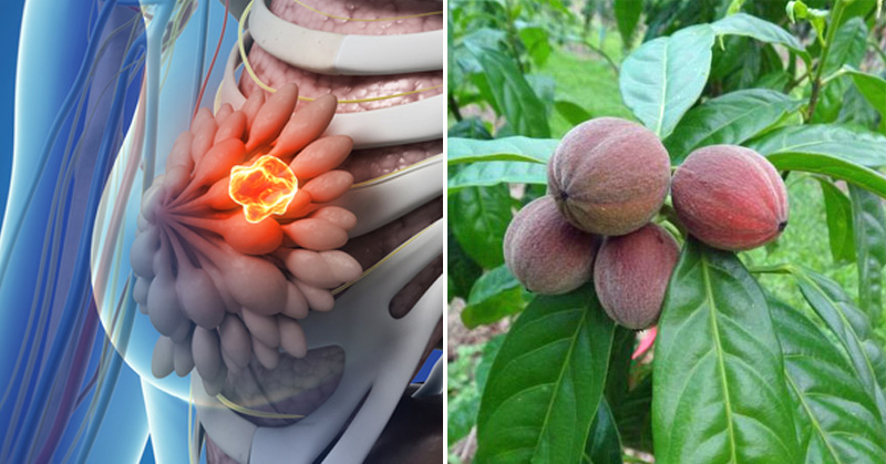 ebc 46 extrait de la fontainea picrosperma est un anti cancer naturel puissant comme les amandes amères d'abricot, l'artemisia annua ou les feuilles de graviola corossol